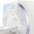 apparat-mrt-siemens-magnetom-skyra_5