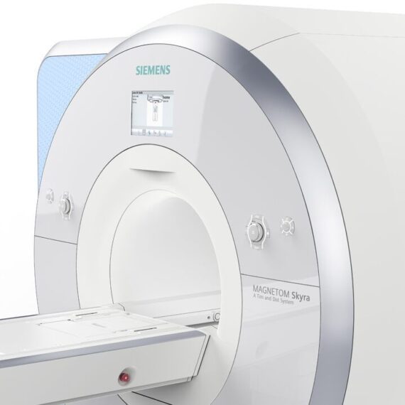 apparat-mrt-siemens-magnetom-skyra_5