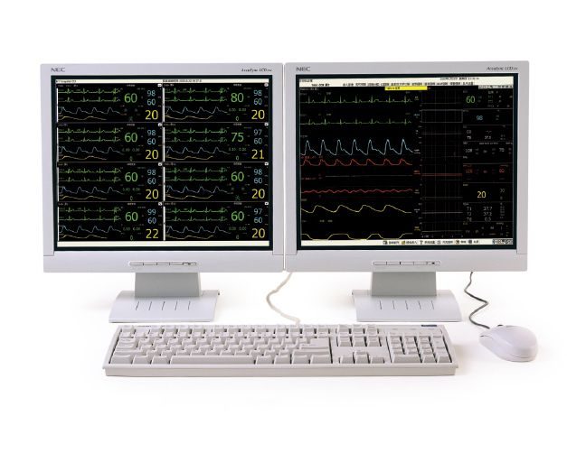 centralnaya-sistema-monitoringa-mindray-hypervisor-vi