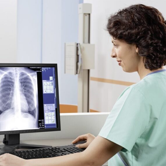 diagnosticheskij-rentgen-apparat-siemens-multix-select-dr_8