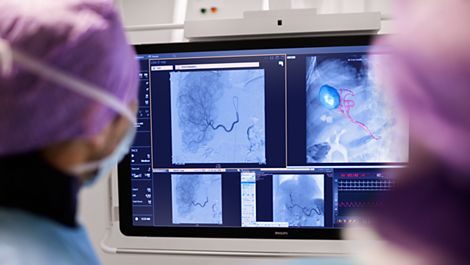 intervencionnaya-rentgenovskaya-sistema-philips-flexvision-xl