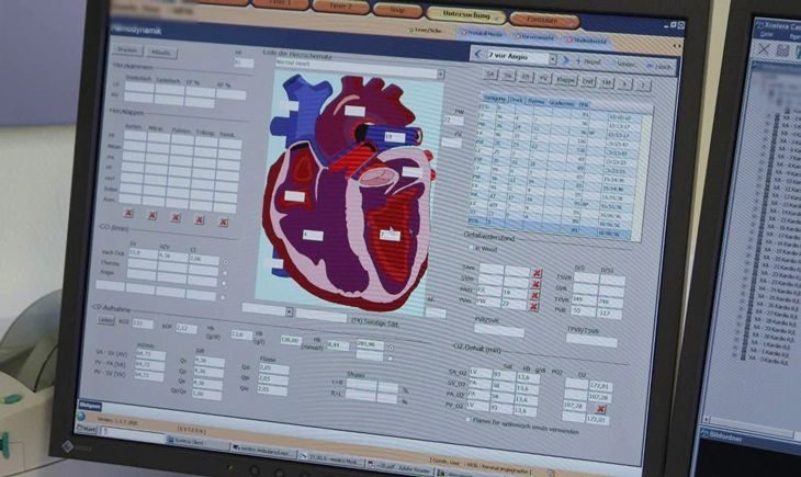 intervencionnaya-rentgenovskaya-sistema-philips-xper-flex-cardio_3