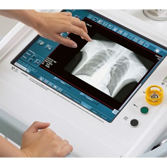 mobilnij-rentgenovskij-apparat-canon-mobirex_2