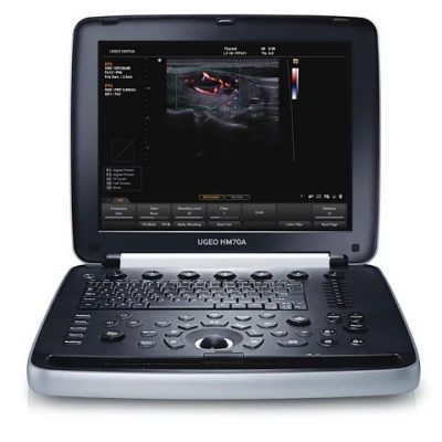 portativnij-uzi-apparat-samsung-medison-hm70a