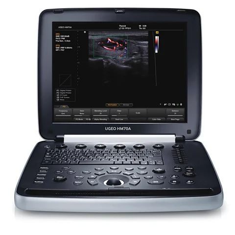 portativnij-uzi-apparat-samsung-medison-hm70a