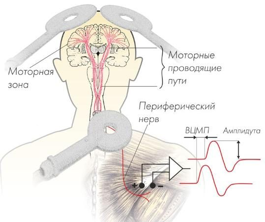 transkranialnij-magnitnij-stimulyator-nejrosoft-nejro-msd-diagnosticheskij_11