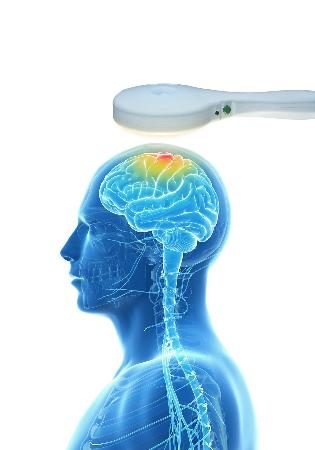 transkranialnij-magnitnij-stimulyator-nejrosoft-nejro-msd-diagnosticheskij_3