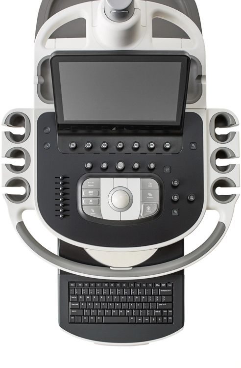 uzi-apparat-philips-epiq-7_2