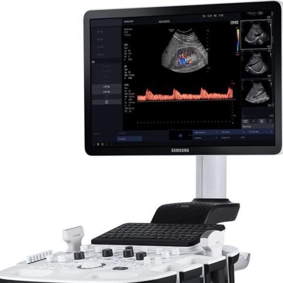 uzi-apparat-samsung-medison-hs30_4